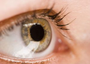 How to Manage LASIK Aftercare for Fast Recovery in Jacksonville, FL