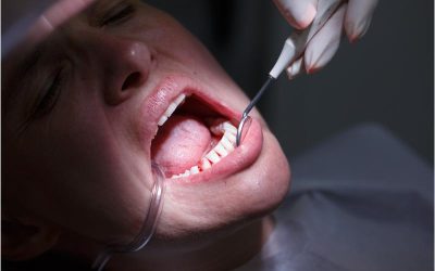 Knocked-Out Teeth to Abscessed Gums: Recognizing the Signs of a Dental Emergency in Long Branch, NJ